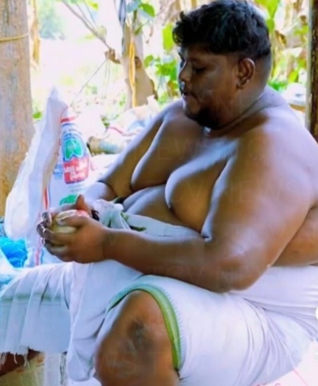 മുണ്ടത്തിക്കോട് വെടിക്കെട്ട് പുര ദുരന്തത്തിൽ ചികിത്സയിലായിരുന്ന ഒരാൾ കൂടി മരിച്ചു