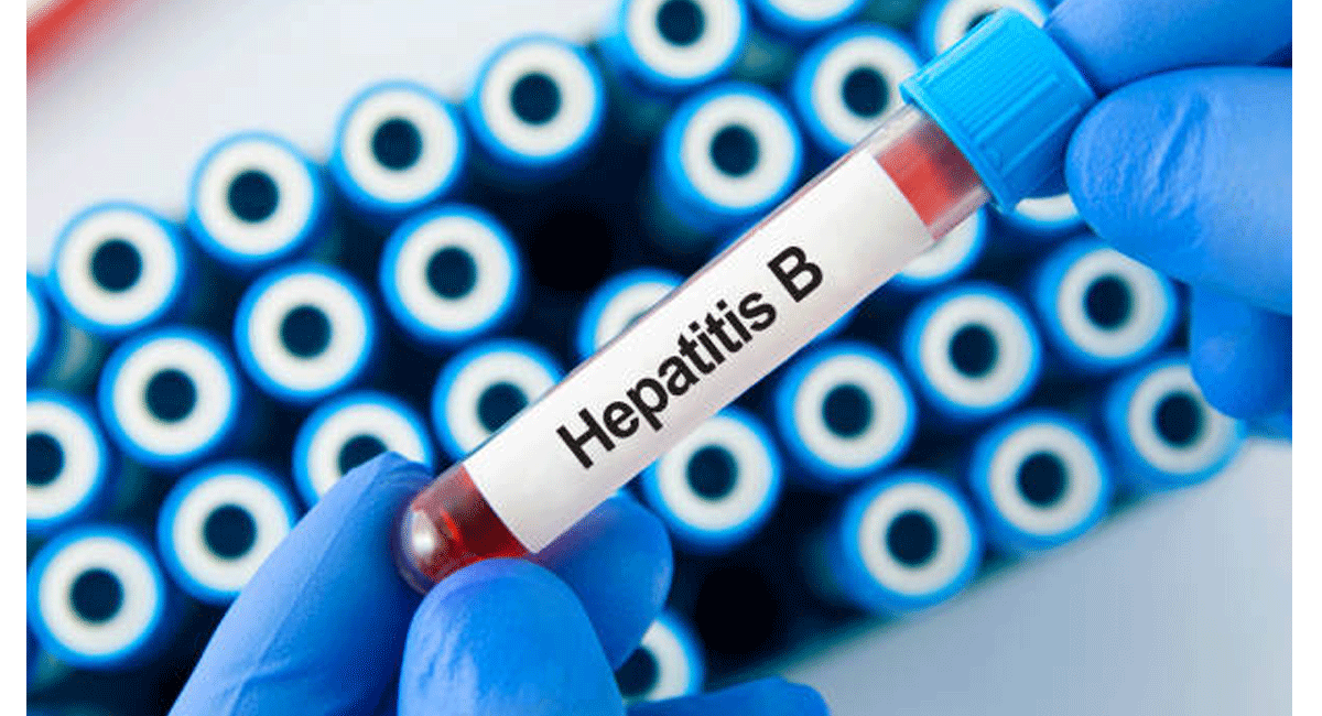 HEPATITIS
